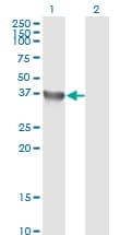 IHC-plus™ GYG1 / Glycogenin Antibody (clone 3B5)