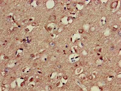 AP50 / AP2M1 Antibody