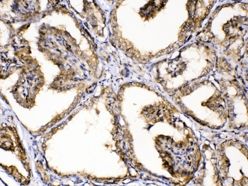 GAPDH Antibody