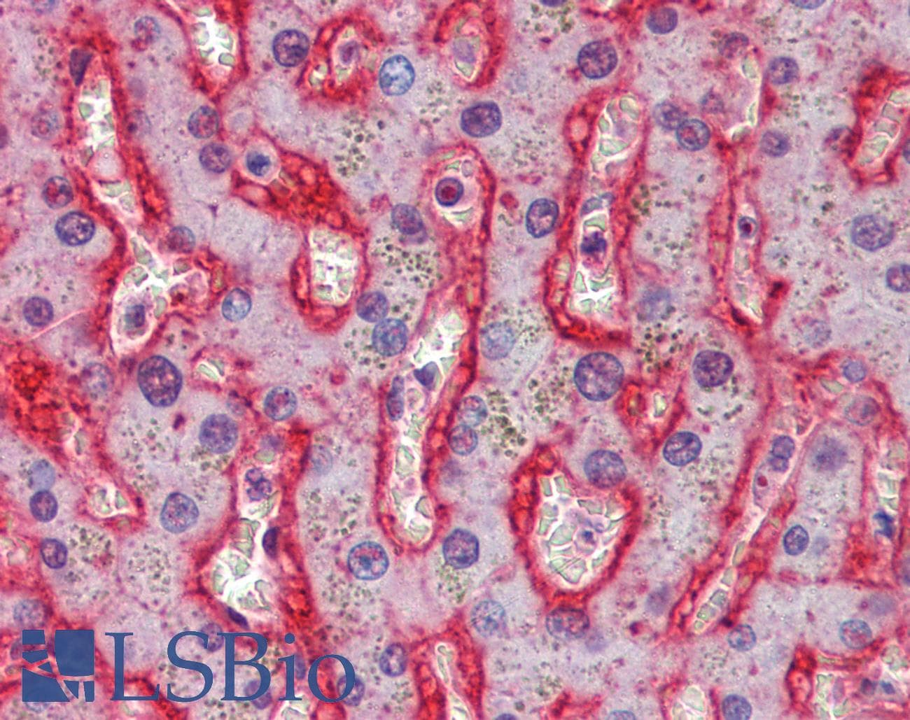 IHC-plus™ Polyclonal Goat anti-Human SLC2A2 / GLUT2 Antibody (aa277-290, IHC, IF)