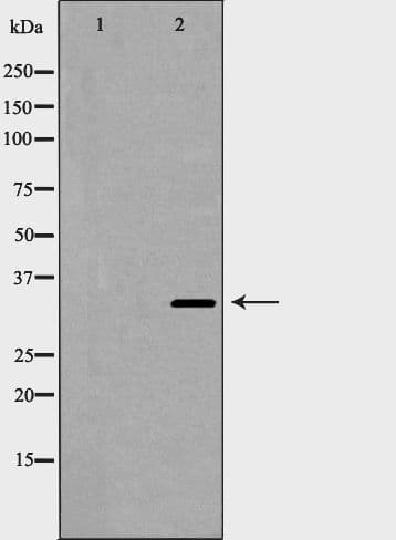 CCND2 / Cyclin D2 Antibody
