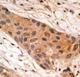 BNIP1 Antibody (aa92-127)