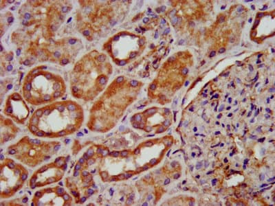 Polyclonal Rabbit anti-Human PDSS2 / DLP1 Antibody (IHC)