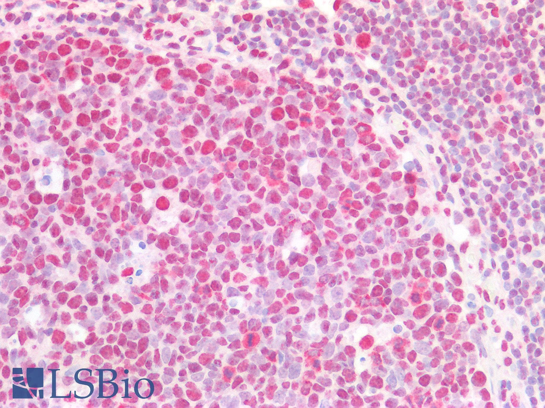 IHC-plus™ CSTF2 / CstF-64 Antibody (aa309-320)