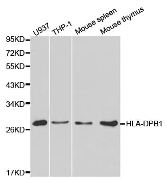 HLA-DPB1 Antibody