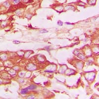 TNFRSF1B / TNFR2 Antibody (C-Terminus)