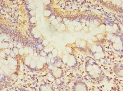 TCP11L2 Antibody