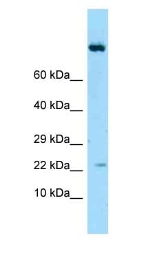 IL19 Antibody (aa97-146)