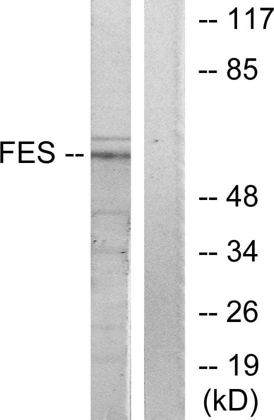FES Antibody
