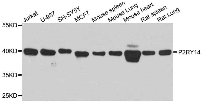 Polyclonal Rabbit anti-Human P2RY14 / GPR105 Antibody (WB)