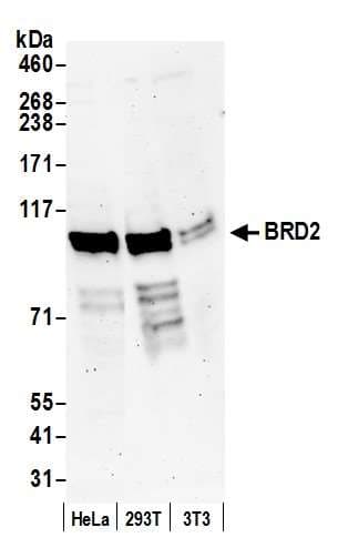 IHC-plus™ Polyclonal Rabbit anti-Human BRD2 / RING3 Antibody (aa675-725, IHC, IF, WB)
