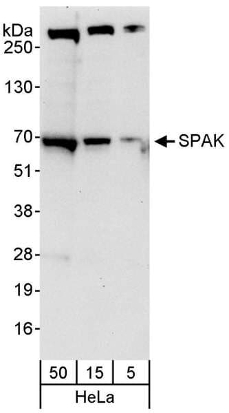 STK39 / SPAK Antibody (aa375-425)