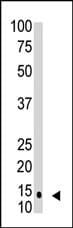 SUMO1 / SMT3 Antibody (clone 66AT1273.94)