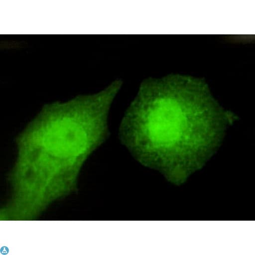 TBL1XR1 / TBLR1 Antibody