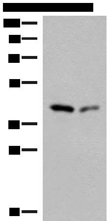 Polyclonal Rabbit anti-Human GIPC1 / GIPC Antibody (WB)