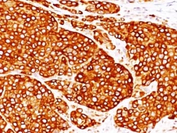 Tyrosinase Antibody (clone T311 + OCA1/812)