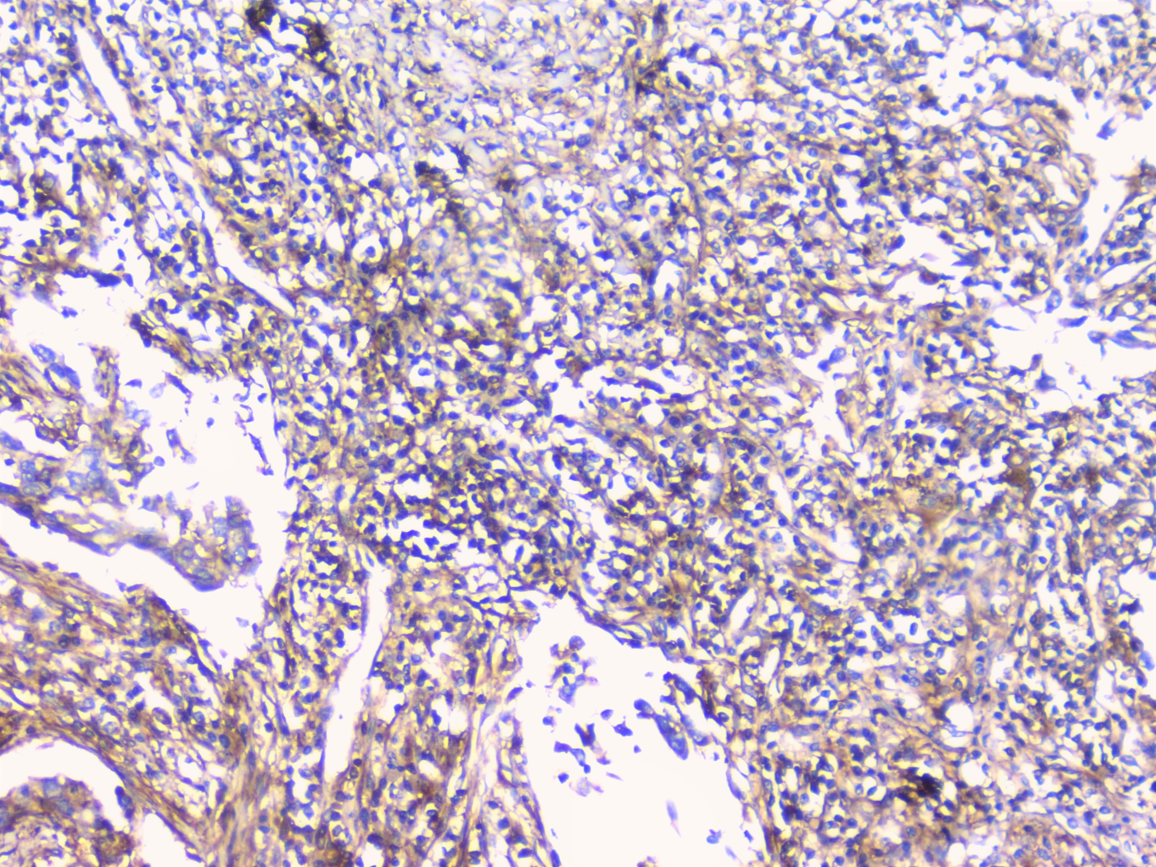 CD32A Antibody