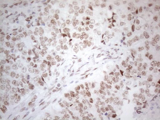 HDAC2 Antibody (aa415-488, clone OTI7E10)