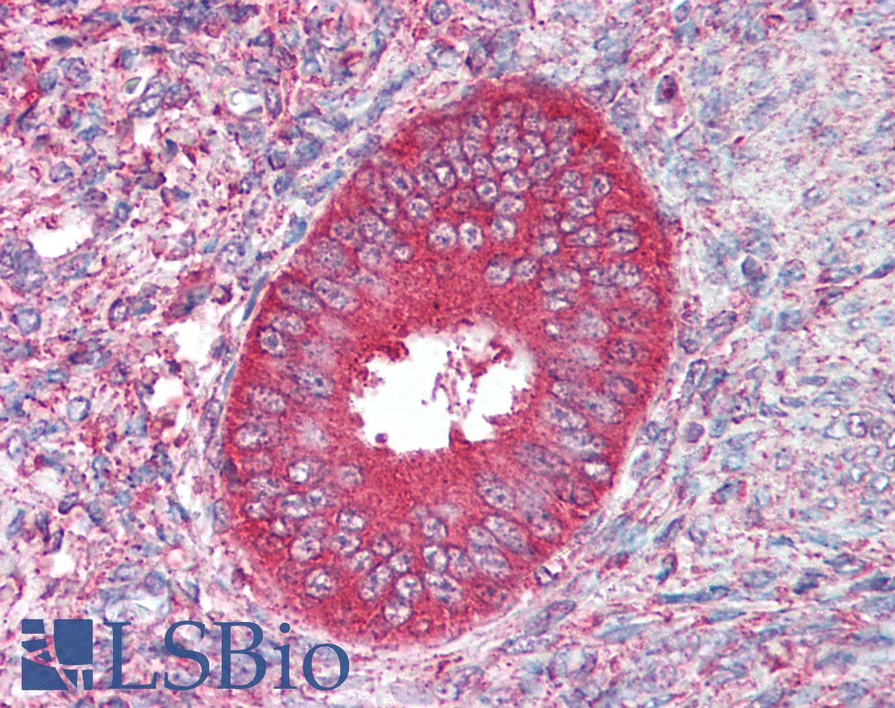 CDX2 Antibody (aa161-210)