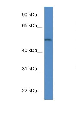 Polyclonal Rabbit anti-Mouse ARSB / Arylsulfatase B Antibody (aa300-349, WB)