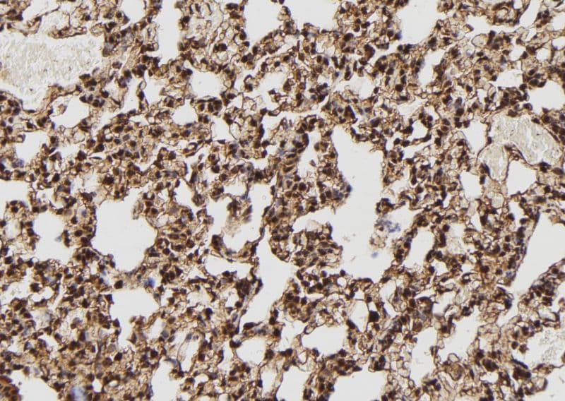 SHSF1 / SHFM1 Antibody (aa21-40)