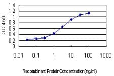 Monoclonal Mouse anti-Human Pyrin / MEFV / MEF Antibody (clone 4E6, WB)