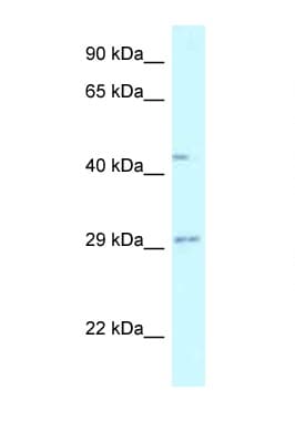 FUT8 Antibody (aa27-76)