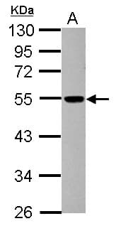 DCTN4 / Dynactin 4 Antibody