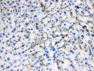 Polyclonal Rabbit anti-Human ABCB11 / BSEP Antibody (IHC, WB)