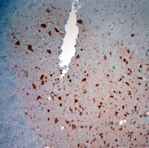Polyclonal Rabbit anti-Human NeuN Antibody (aa80-130, IHC, WB)