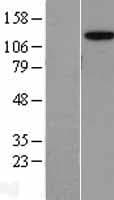 AP3B2 Protein (Over-Expression Lysate Myc-DDK (Flag))