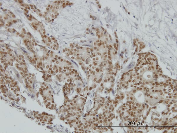 PR / Progesterone Receptor Antibody (clone 3E11)