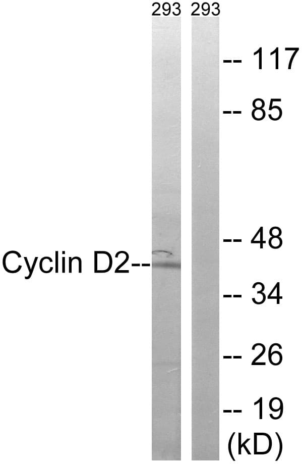 Polyclonal Rabbit anti-Human CCND2 / Cyclin D2 Antibody (aa240-289, WB)