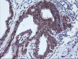 Monoclonal Mouse anti-Human ALOX15 / 15-Lipoxygenase Antibody (clone OTI3G8, IHC, IF, WB)