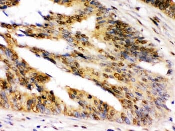 Polyclonal Rabbit anti-Human NIRF / UHRF2 Antibody (IHC, WB)