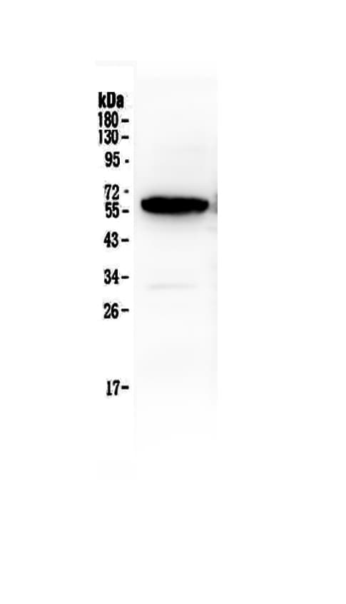 Polyclonal Rabbit anti-Human SDC1 / Syndecan 1 / CD138 Antibody (WB)