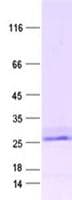 Human PRR15 Protein (Recombinant DDK,C-terminus)