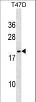 Polyclonal Rabbit anti-Human NME6 Antibody (aa80-110, WB)