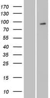 Human MYSM1 Protein (Over-Expression Lysate Myc-DDK (Flag))