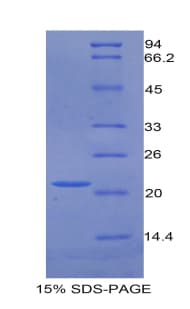 Mouse GAS6 Protein (Recombinant 6His, N-terminus)