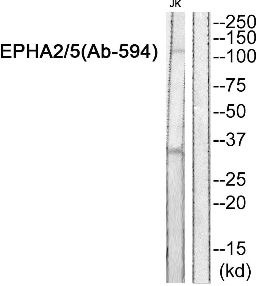 Polyclonal Rabbit anti-Human EPHA2 + EPHA5 Antibody (p594, WB)