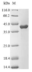 Rabbit TPM1 / Tropomyosin Protein (Recombinant 10His, N-terminus + Myc, C-terminus)