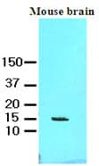 IHC-plus™ Monoclonal Mouse anti-Human FABP7 / BLBP / MRG Antibody (clone AT1D1, aa1-132, IHC, WB)