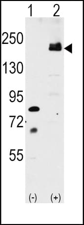 LRP6 Antibody (aa1531-1560)