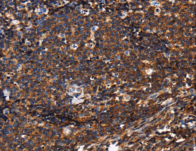 CD45 / LCA Antibody