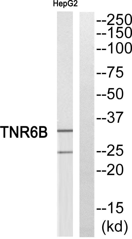 Polyclonal Rabbit anti-Human TNFRSF6B / DCR3 Antibody (IHC, IF, WB)