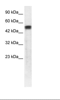 PathPlus™ Polyclonal Rabbit anti-Human SERPINA1 / Alpha 1 Antitrypsin Antibody (C-Terminus, IHC, WB)