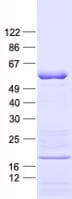 Human Yo / CDR2 Protein (Recombinant His, N-Terminal)