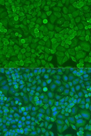 DICER1 / Dicer Antibody