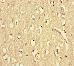 WAC Antibody